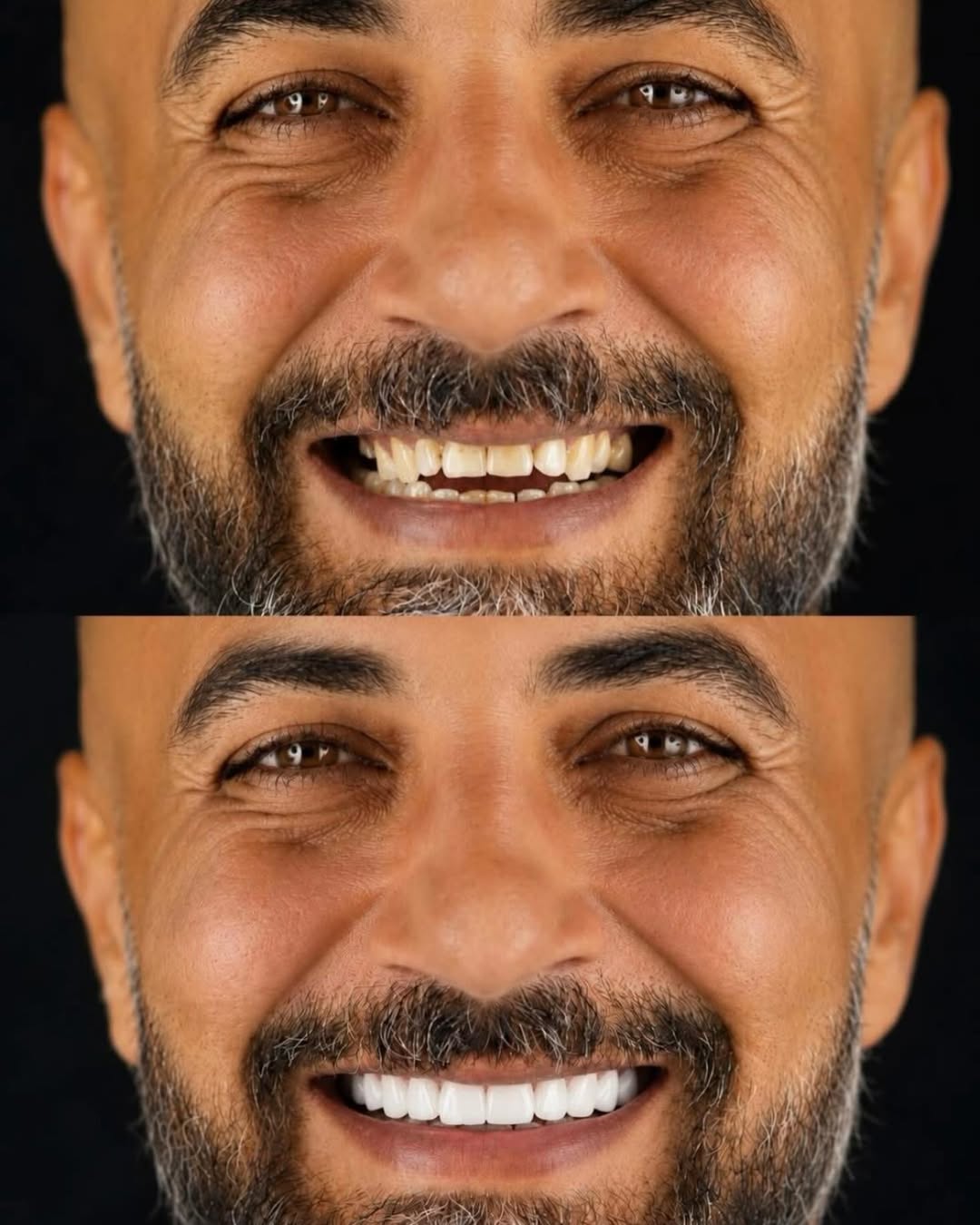 smile before after